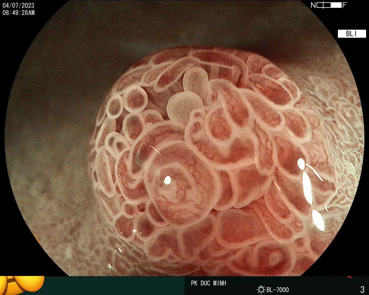 Dây soi Zoom Mặc định